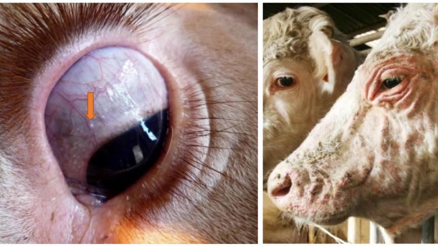 De petits kystes sur la sclère apparaissent environ 1 mois après le début de la maladie, c’est un signe très spécifique de la maladie. On observe ensuite un épaississement cutané durable (peau d’éléphant) .
